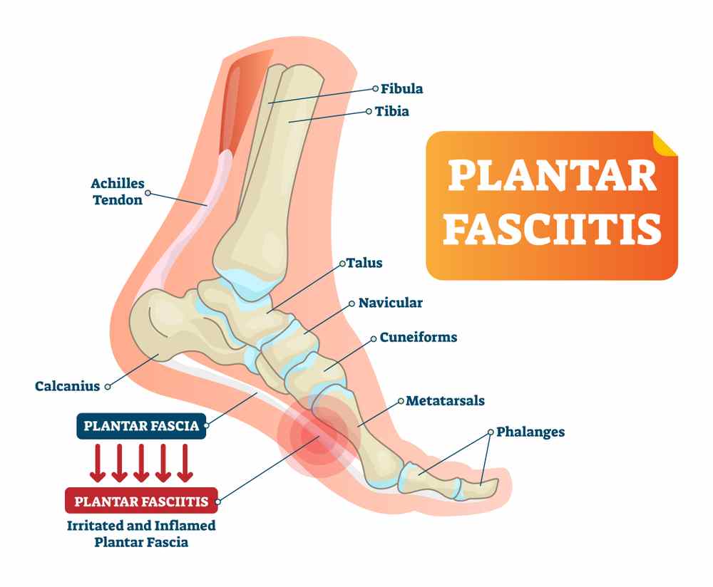 best plantar fasciitis shoes