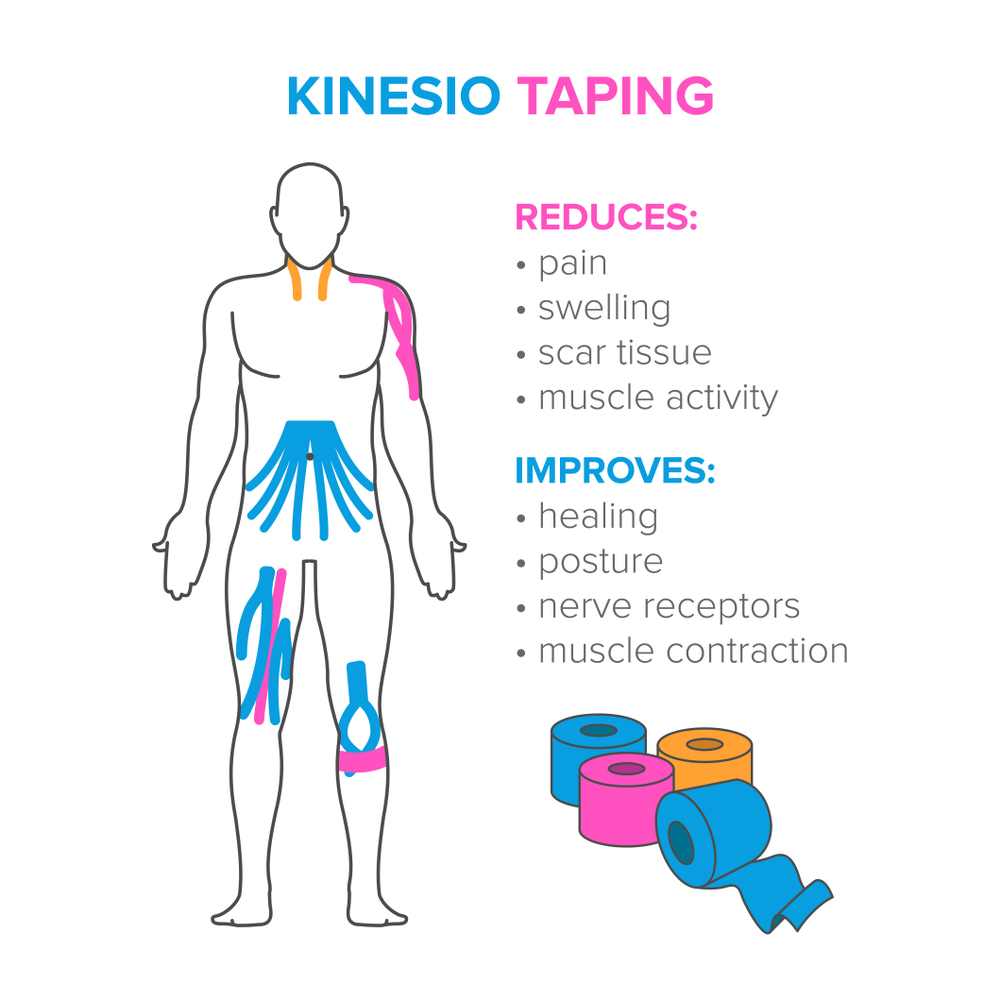 kinosiology taping benefits for heel pain