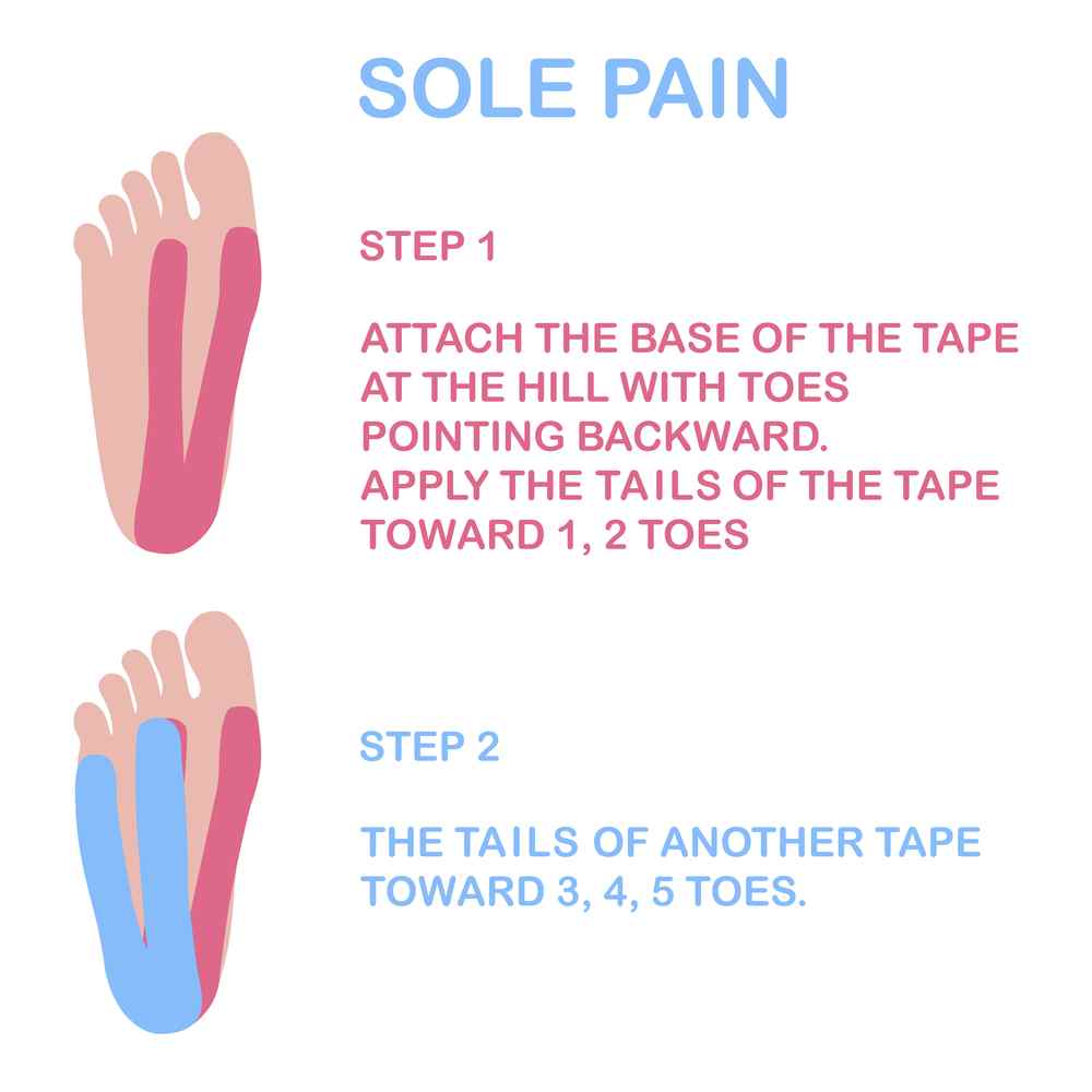 most effective taping for heel pain